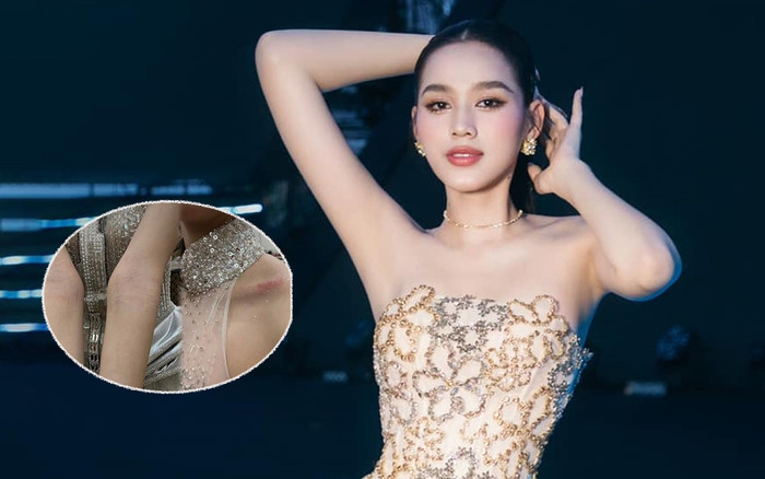 Đỗ Thị Hà đăng tải ảnh thân thể trầy xước trong đêm khiến fan xót xa Ảnh 2