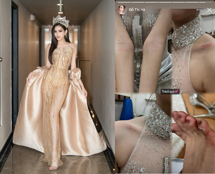 Người và chân của nàng hậu xuất hiện nhiều vết xước, sưng đỏ do phải tập diễn với thiết kế trang phục dân tộc to lớn, công phu.