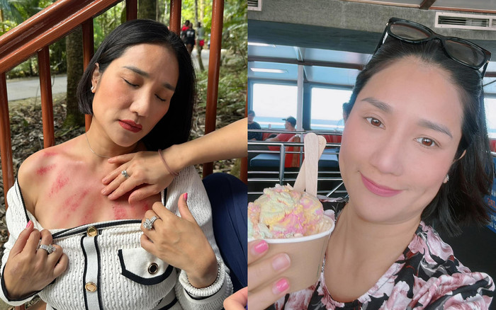 Sức khỏe NSƯT Cát Tường hiện tại ra sao sau khi bị ngã bên đường phải cạo gió? Ảnh 2