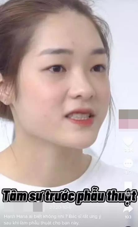 Thế nhưng, khi đối chiếu với loạt ảnh quá khứ, không ít khán giả bày tỏ sự ngạc nhiên trước màn 'lột xác' dung mạo hoàn toàn của người đẹp sinh năm 2000. 