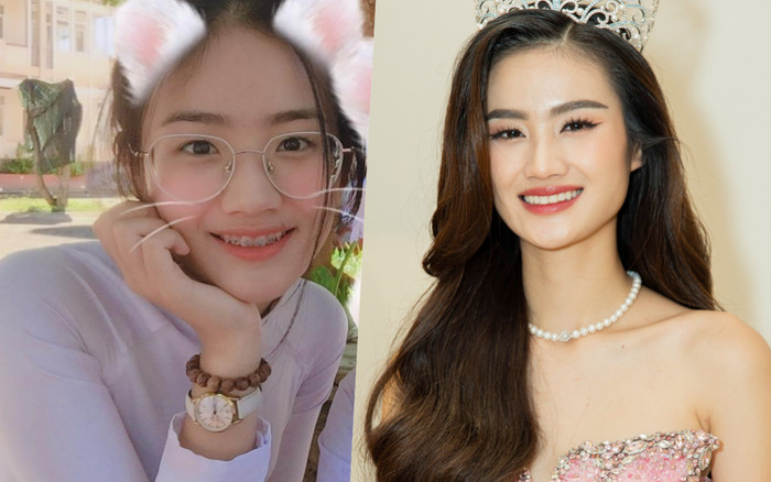 Hoa hậu Ý Nhi thăng hạng nhan sắc nhờ niềng răng Ảnh 2