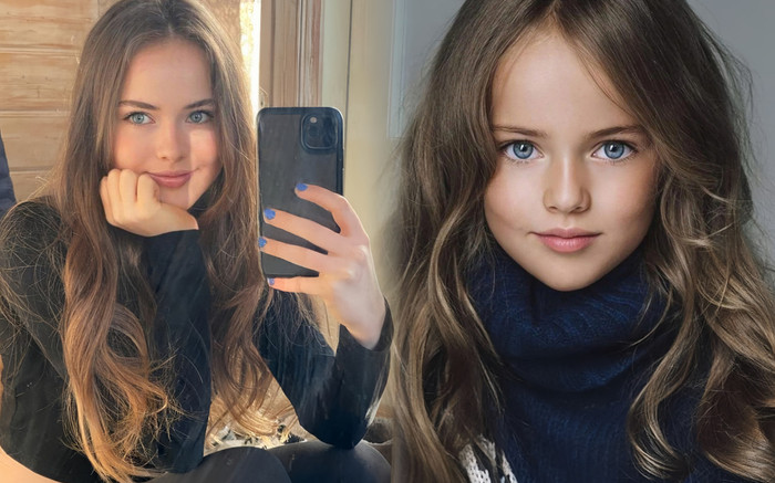 Say đắm sắc vóc thuở thiếu thời của 'bé con đẹp nhất thế giới' Ảnh 2