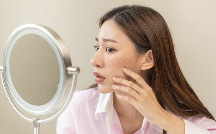 Dị ứng mỹ phẩm: Câu chuyện phổ biến mà các nàng thường né tránh Ảnh 2
