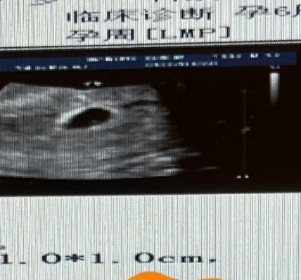 Thành Nghị lộ chuyện có con, danh tính mẹ đứa bé có gì mà gây chú ý? Ảnh 2