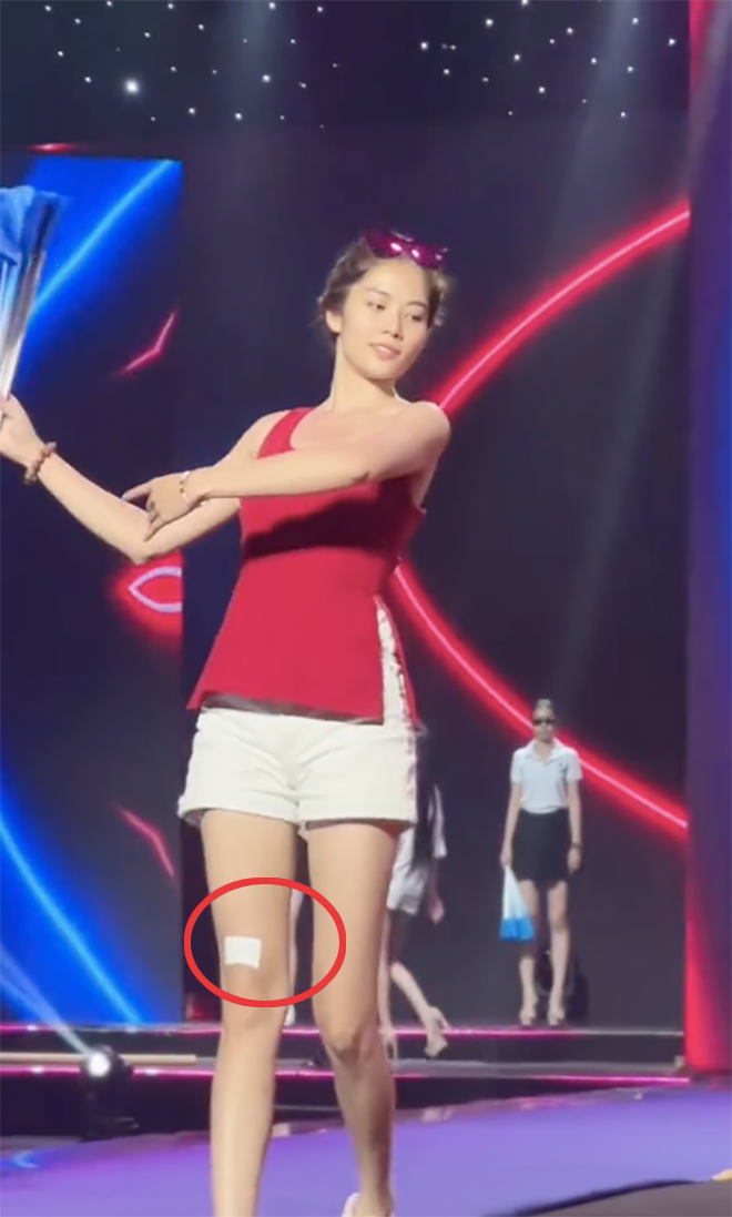 Lệ Nam gặp vấn đề ở chân trước thềm chung kết Miss Universe Vietnam 2023 Ảnh 2