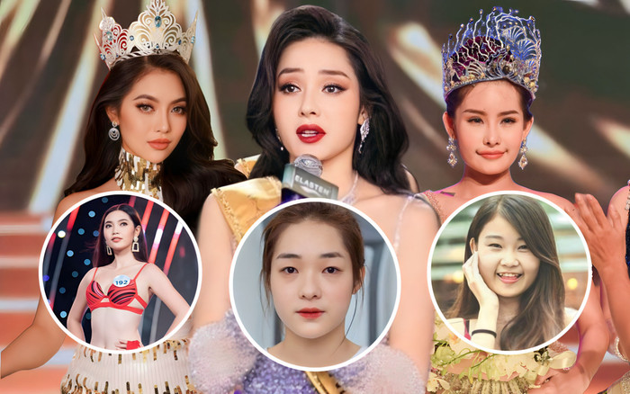 Những người đẹp 'sửa mặt' đi thi hoa hậu vẫn được đăng quang như thường Ảnh 2