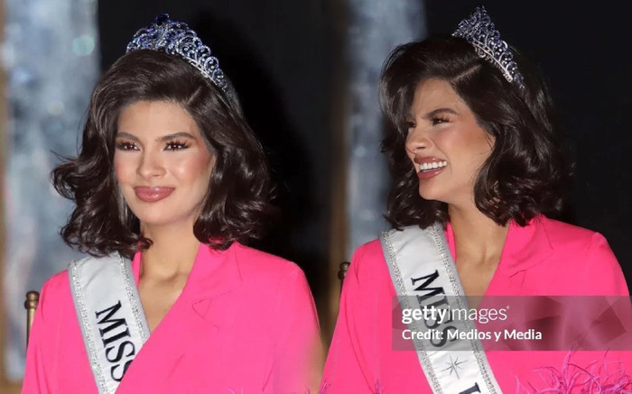 'Khóc thét' với nhan sắc của Hoa hậu Hoàn vũ 2023: Ai hại chị vậy? Ảnh 2