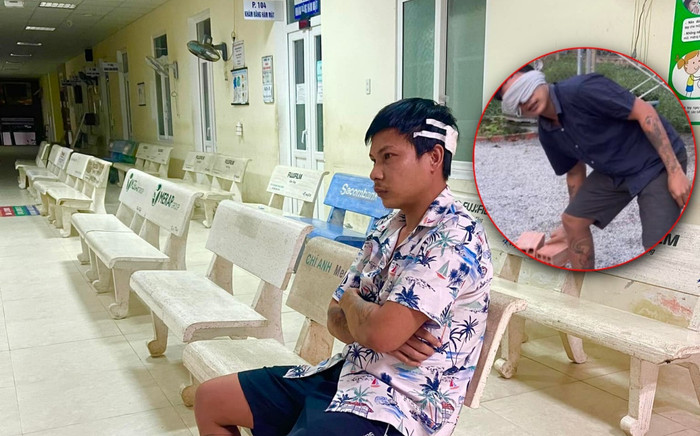 Lộc Fuho thẩn thờ ở bệnh viện với vết băng bó sau đầu, lên mạng than phiền buồn bã Ảnh 2