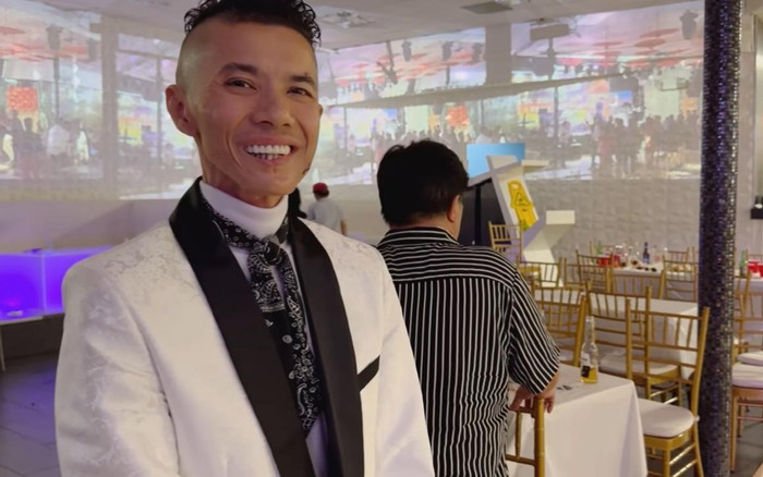 Nam ca sĩ phải cắt bỏ toàn bộ xương hàm, trên mặt toàn đồ giả, hiện chưa được phẫu thuật Ảnh 2