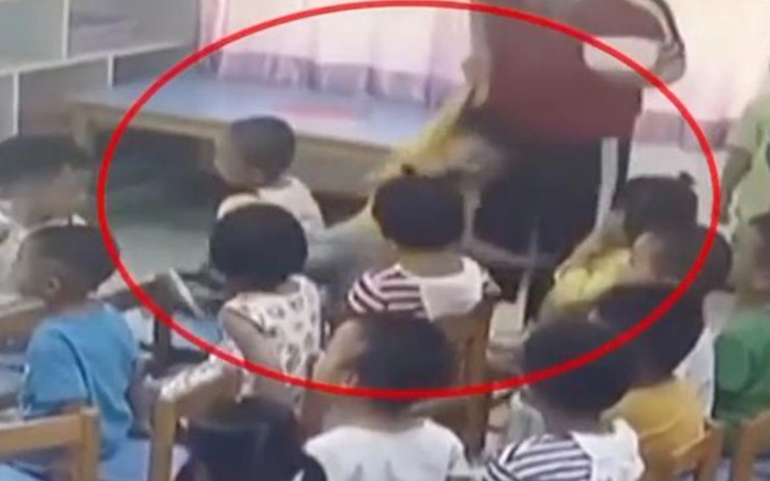 Con bị thương nặng, cô giáo giấu sự thật: Gia đình kiểm tra camera và kết quả bất ngờ Ảnh 2