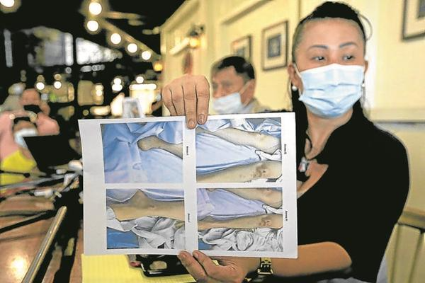 Theo khám nghiệm tử thi, trên người của nạn nhân xuất hiện nhiều vết thương.