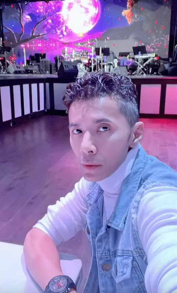 Căn bệnh khiến gương mặt anh bị lệch, một phần cằm biến dạng.