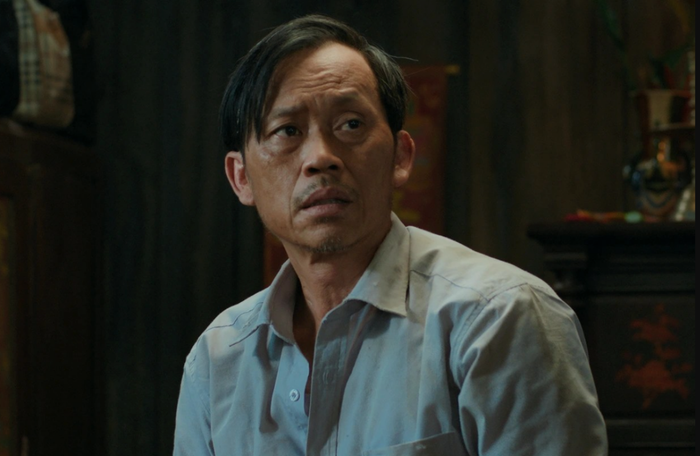 Hoài Linh mắc bệnh ung thư tuyến giáp và mất ngủ suốt nhiều năm.&nbsp;