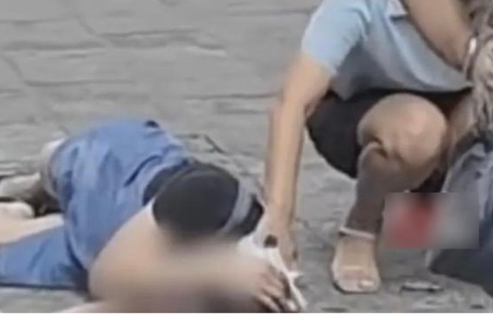 Cô gái thành người thực vật chỉ sau một đêm do kẹp tóc bằng kim loại.