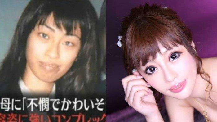 Sau nhiều năm chịu đựng sự miệt thị từ chính mẹ ruột, Tsubaki Tomomi quyết định phẫu thuật thẩm mỹ để không còn làm mẹ 'ngứa mắt'. 