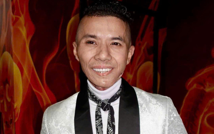 Nam ca sĩ phải cắt bỏ hoàn toàn xương hàm Ảnh 2