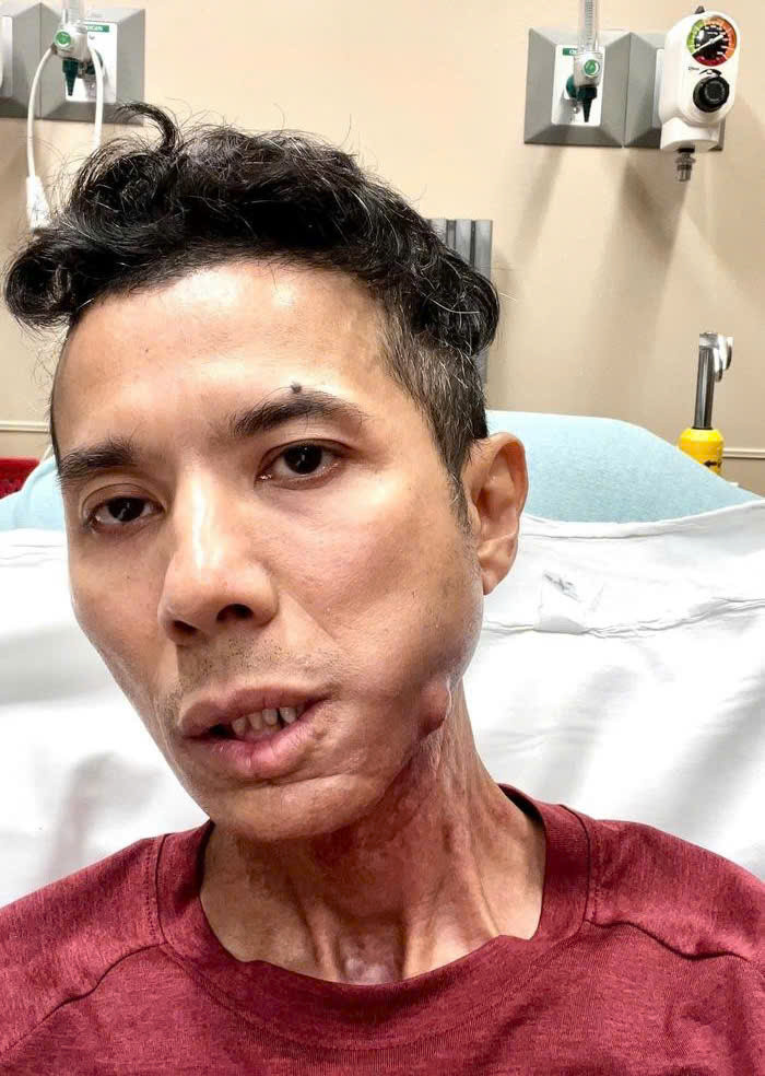 Kasim sụt khá nhiều cân so với trước đây.