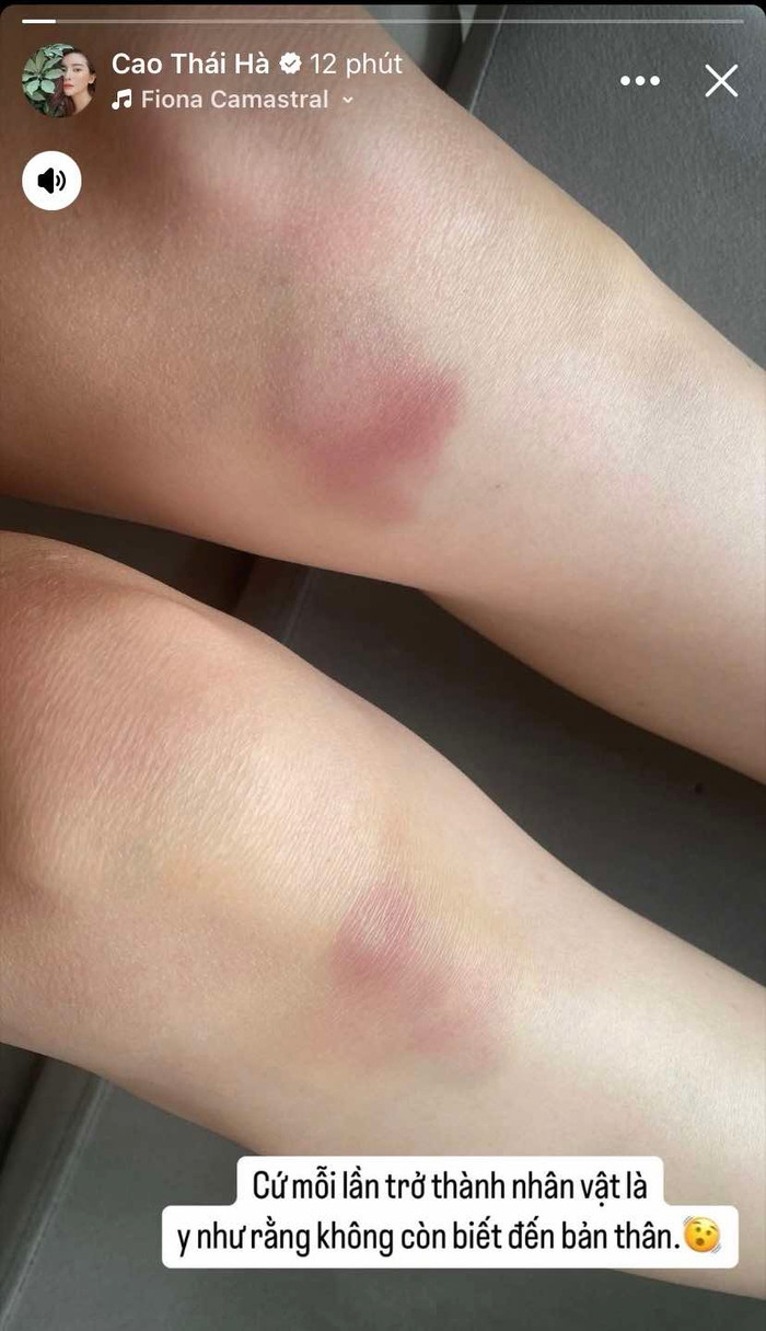 Cao Thái Hà bị thương trong quá trình đóng phim.