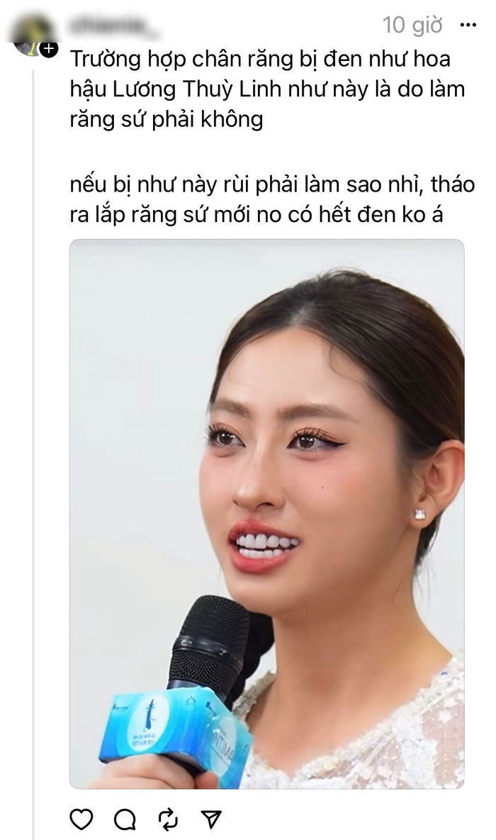 Hoa hậu Lương Thùy Linh bị bàn tán với bức ảnh hàm rằng đen.