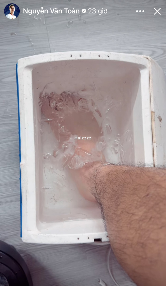 Tiền đạo Văn Toàn đã cập nhật tình trạng điều trị chấn thương. Ảnh: Nguyễn Văn Toàn