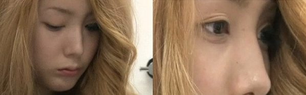 Lớp trang điểm trong hai năm của Dal-mi được cởi bỏ. Bác sĩ phát hiện da của người đẹp đã lão hoá gấp hai lần so với tuổi thật của chính mình.  