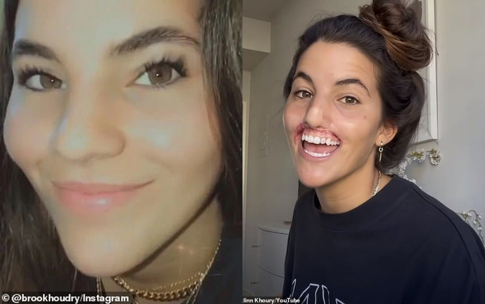 Diện mạo trước và sau của nữ người mẫu khi xảy ra sự việc đáng tiếc.