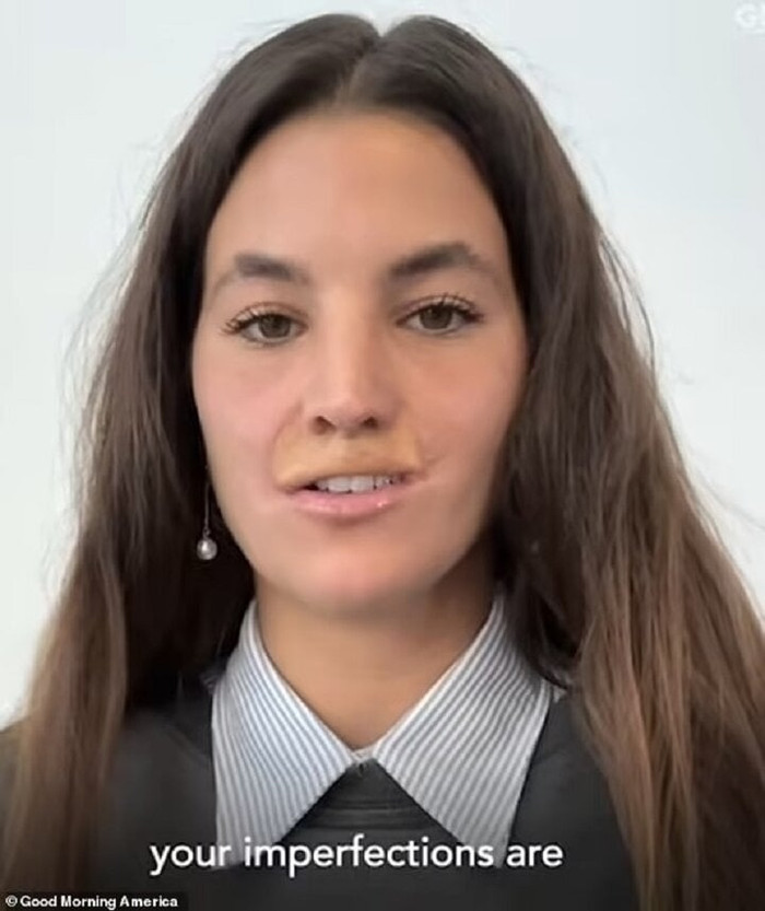 Phần miệng của nữ người mẫu đã được khôi phục khá tốt.