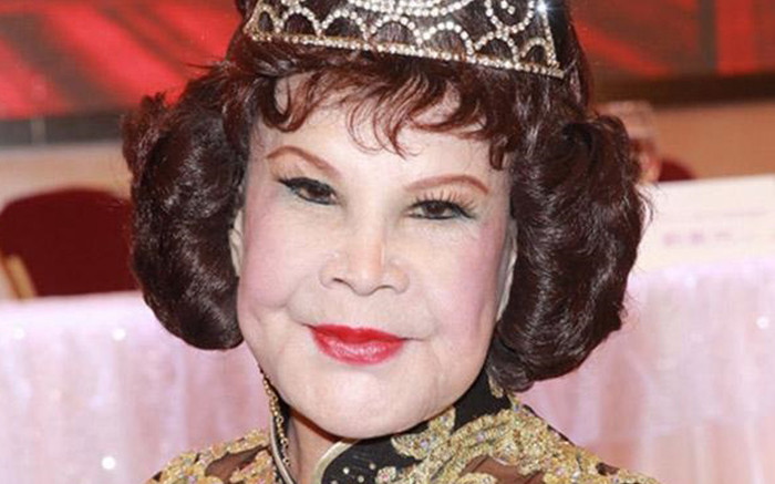 Nữ diễn viên nổi tiếng gây sốc vì gương mặt biến dạng, nguyên nhân phổ biến nhiều người hay mắc Ảnh 2