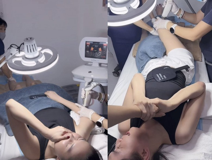 Ngọc Trinh chi 40 triệu để điều trị sẹo.