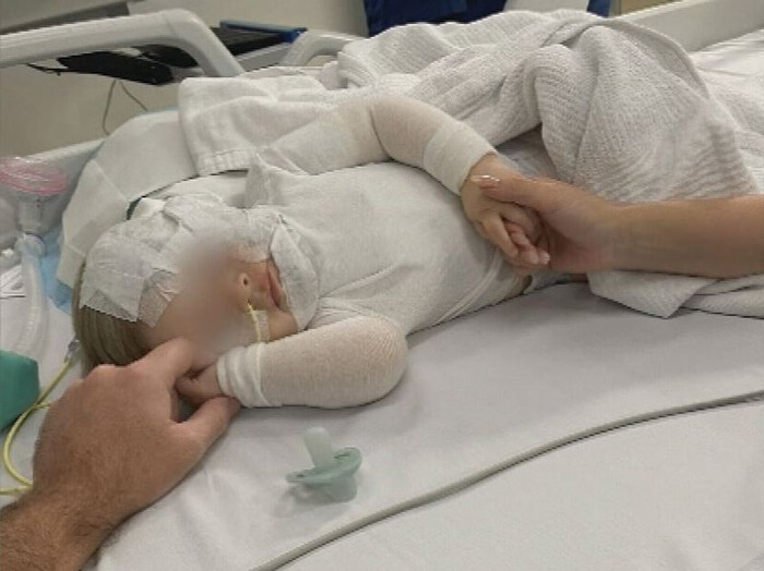 Cậu bé đã trở về nhà với gia đình sau bốn ca phẫu thuật.