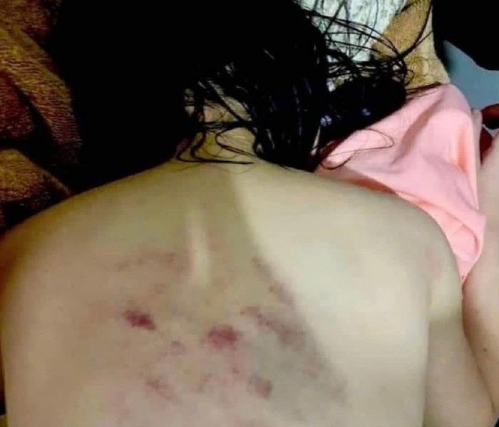 Theo nhiều phụ huynh, việc cô giáo đánh học sinh diễn ra liên tục từ năm này qua năm khác, thậm chí đã bị tố nhiều lần nhưng sau đó vẫn tái phạm.