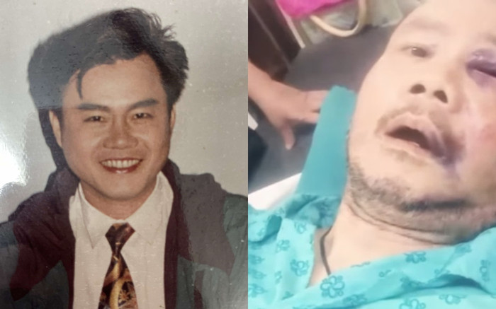 Xót xa tình trạng ca sĩ Tô Thanh Phương sau khi ngã lầu: Mắt tôi mờ quá rồi, chưa mổ được Ảnh 2