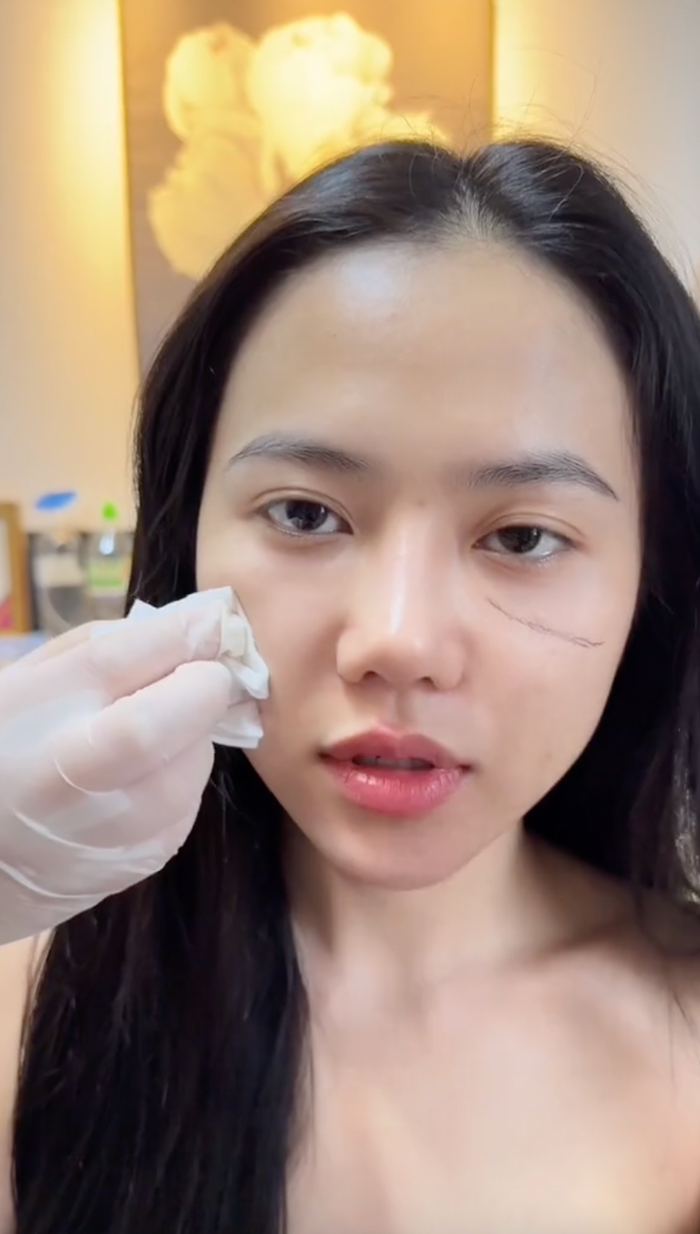 Bạn gái mới của nam streamer không ngại chi tiền cho việc trùng tu bản thân.