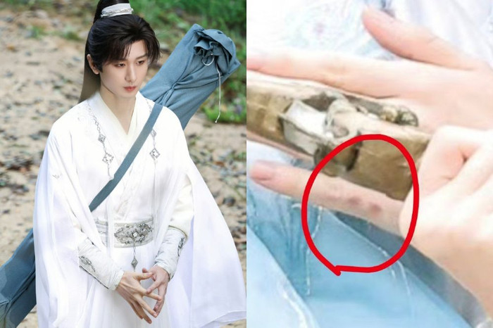 Thành Nghị có nhiều vết bầm tím trong quá trình quay phim. 