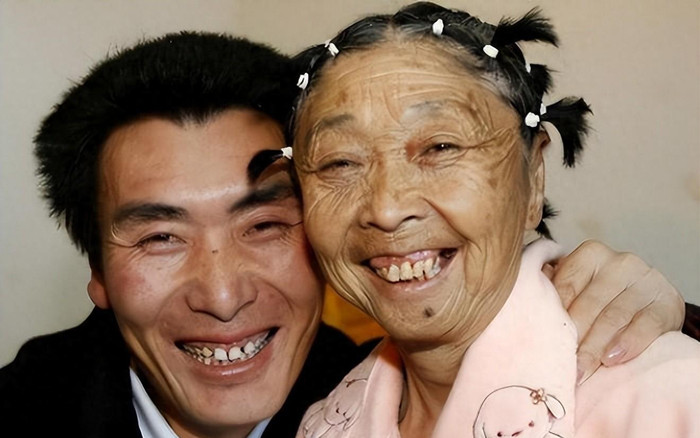 Người phụ nữ 59 tuổi phẫu thuật để kết hôn cùng bạn trai kém 32 tuổi và cái kết Ảnh 2