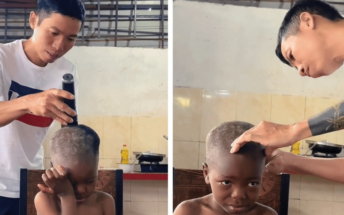 Lôi con phải cạo trọc đầu vì bệnh Ảnh 2