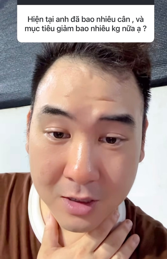 Xemesis sụt 20kg sau ly hôn.