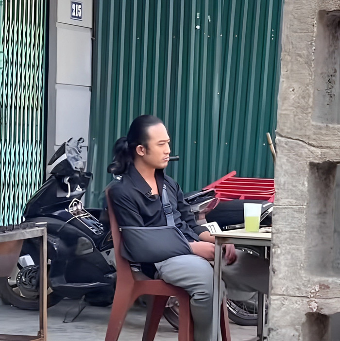 Hình ảnh Doãn Quốc Đam bị gãy tay sau tai nạn bất ngờ được lan truyền trên mạng xã hội. 