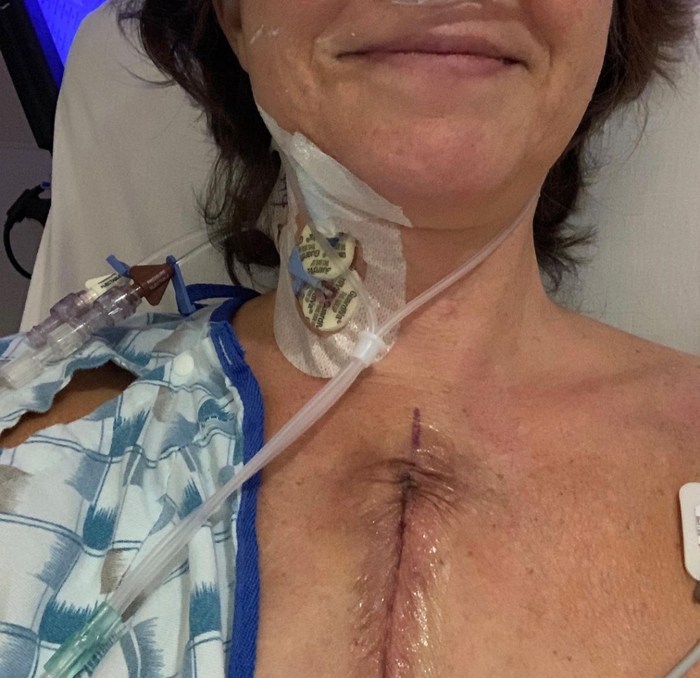 Amy Grant chia sẻ hình ảnh về ca phẫu thuật tim hở của mình.