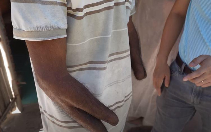 Đôi tay của người đàn ông giống như cái kéo.