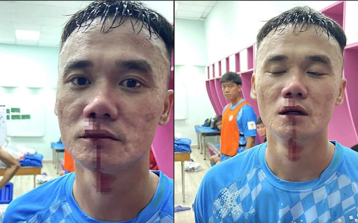 Phạt cực nặng Xuân Nam và Văn Sơn Ảnh 2