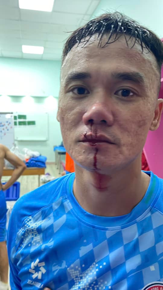 Ban kỷ luật VFF đã có án phạt nặng dành cho Xuân Nam và Văn Sơn sau vụ đánh nhau. Ảnh: PVF  - CAND