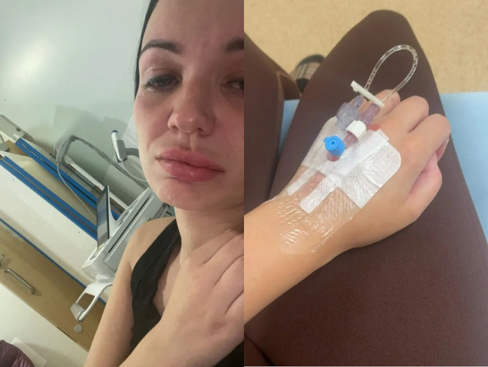 Người mẹ 31 tuổi phải nhập viện vì tiêm thuốc giảm cân giả vào người.