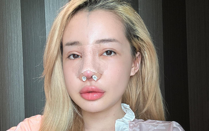 Xôn xao diện mạo mới của Ngân 98, lộ một điểm gây chú ý Ảnh 2