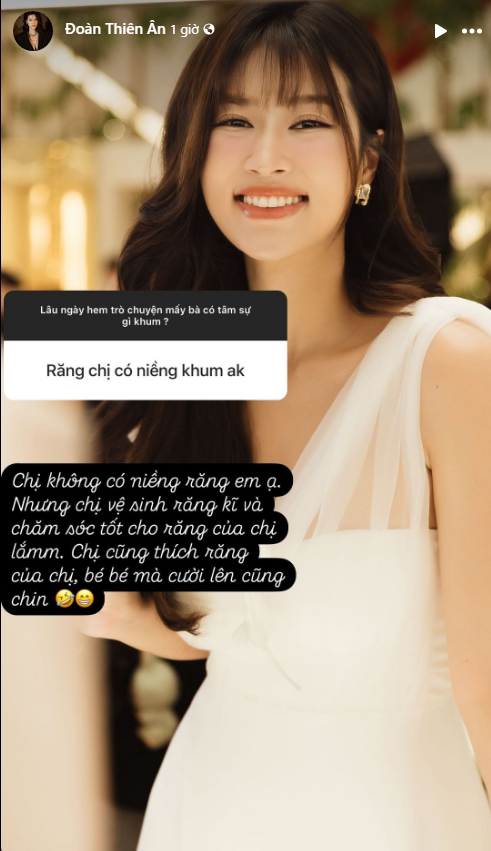 Thiên Ân phủ nhận chuyện niềng răng. (Ảnh FBNV)