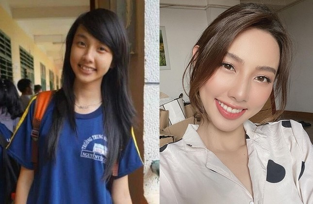 Hoa hậu Thùy Tiên lên hương nhan sắc sau khi chỉnh nha. (Ảnh FBNV)