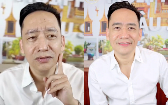 Duy Mạnh khá hài lòng với diện mạo mới sau khi làm lông mày, làm môi. Ảnh: Chụp màn hình