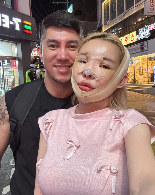 Ngân 98 vừa có chuyến sang Hàn thẩm mỹ.