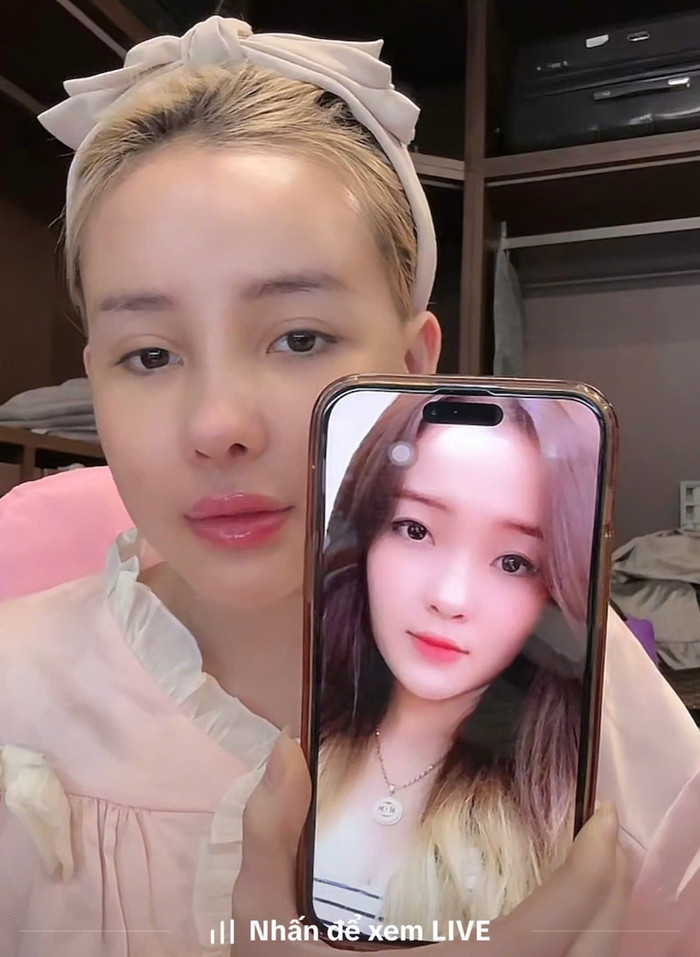 Hình ảnh trước và sau khi thẩm mỹ của Ngân 98.