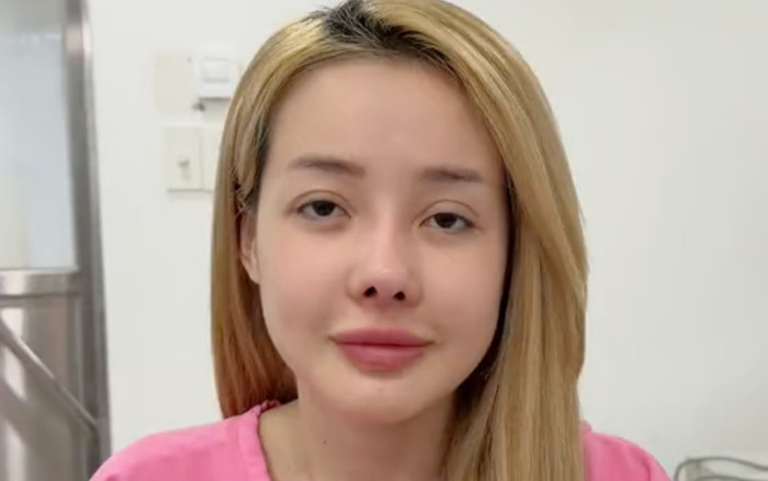 Ngân 98 gặp sự cố đáng lo khi sửa mũi Ảnh 2